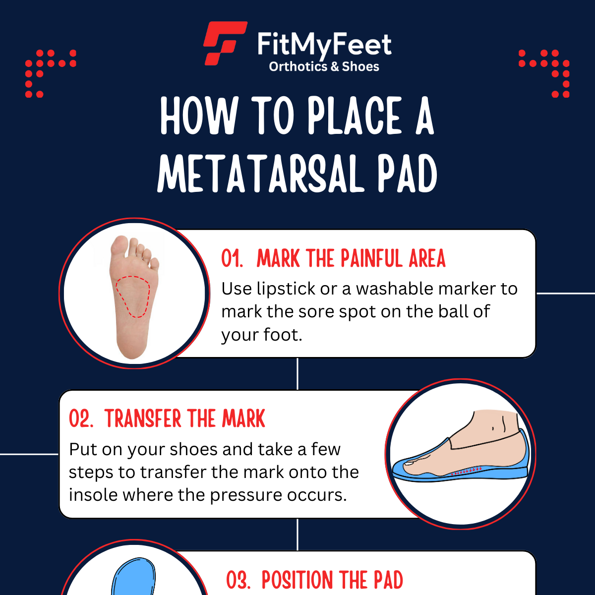 An infographic titled "How to place a metatarsal pad"