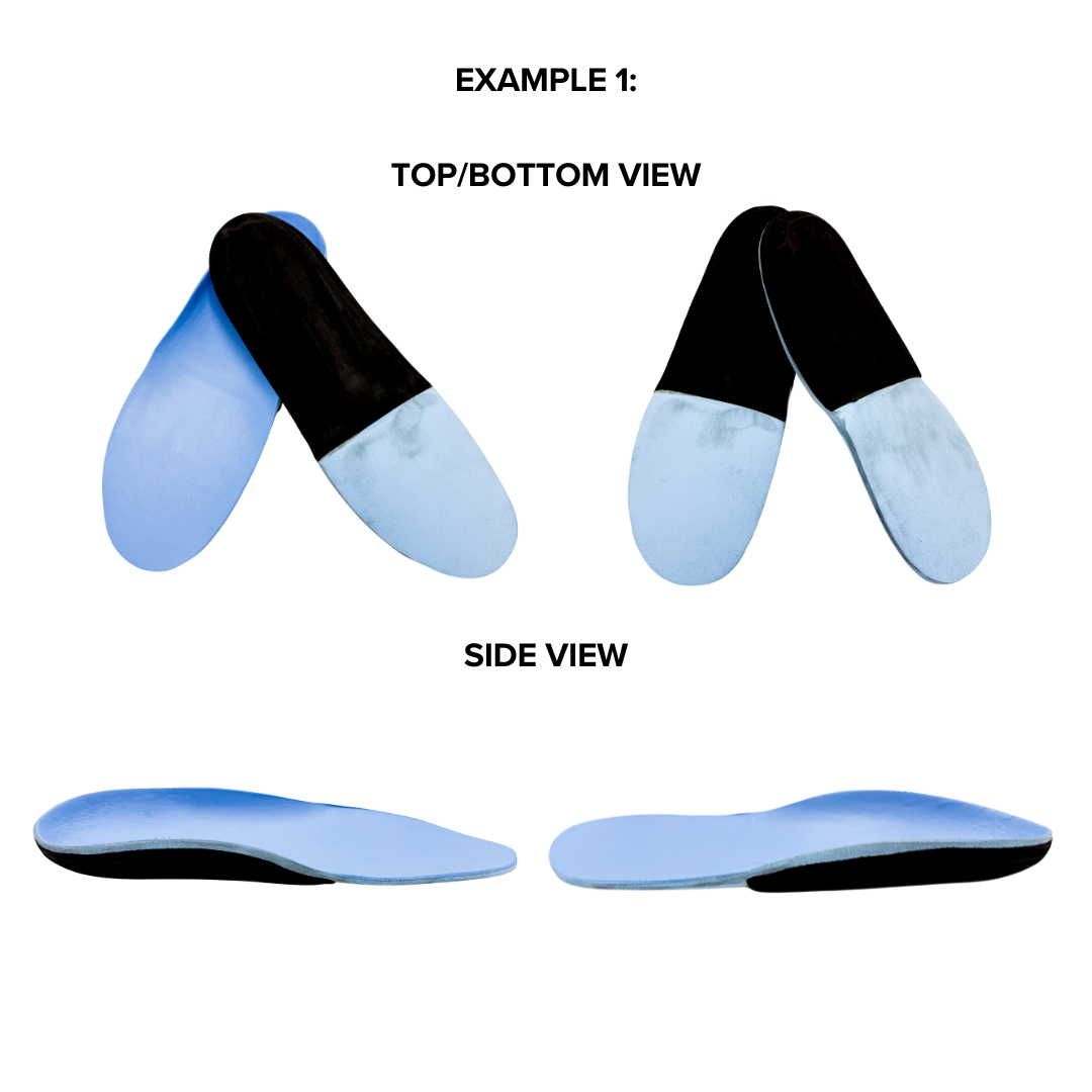 Custom orthotic insoles labeled 'EXAMPLE 1' shown in two views. The top/bottom view displays the blue top surface where the foot rests and the black bottom layer that contacts the shoe interior. The side view highlights the insole’s contoured profile, including built-in arch support and layered construction with blue on top and black underneath.